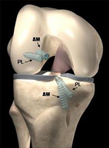 Pro Tips To Have A Speedy Recovery From The Acl Screw Surgery