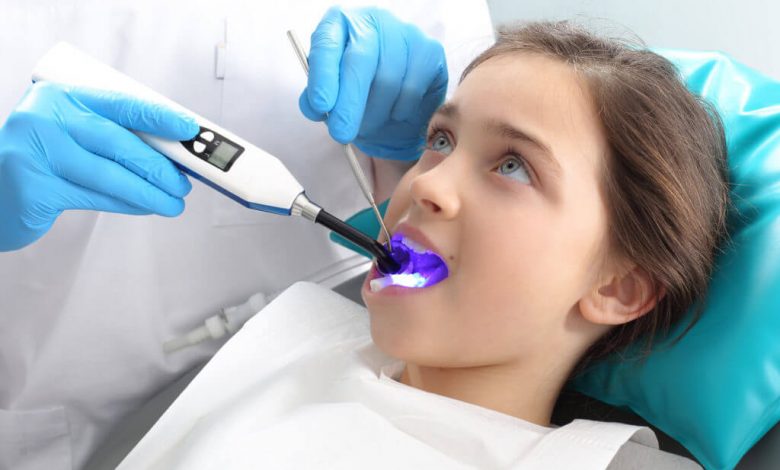 What are Some Benefits of Dental Sealants