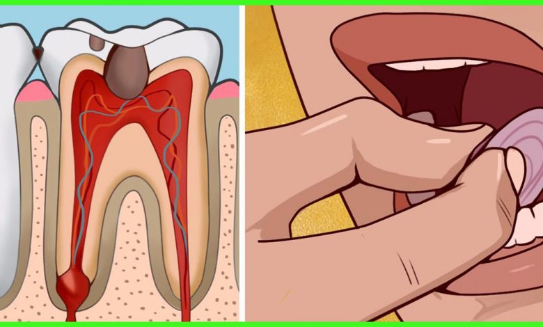 How to Get Emergency Toothache Relief